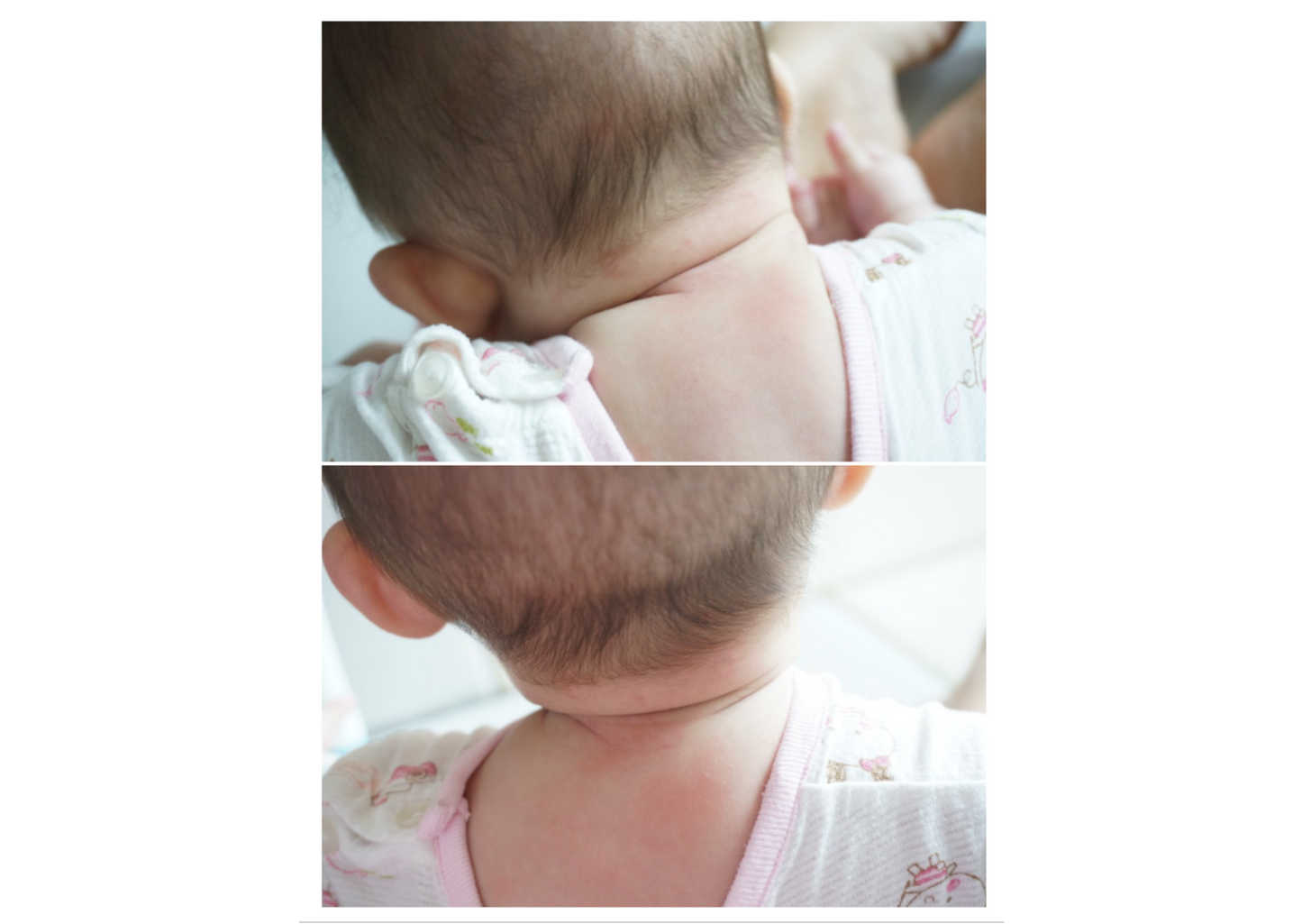 Benefie' BARRIER Renew Cream Korean Moisturizing Cosmetic For Baby Skin, Children and Sensitive Elderly Skin