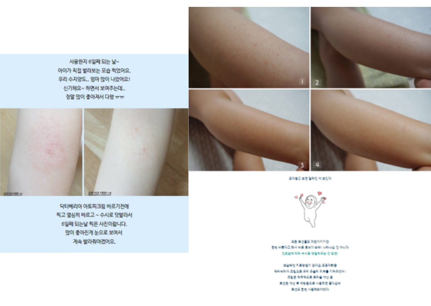 Benefie' BARRIER Renew Cream Korean Moisturizing Cosmetic For Baby Skin, Children and Sensitive Elderly Skin