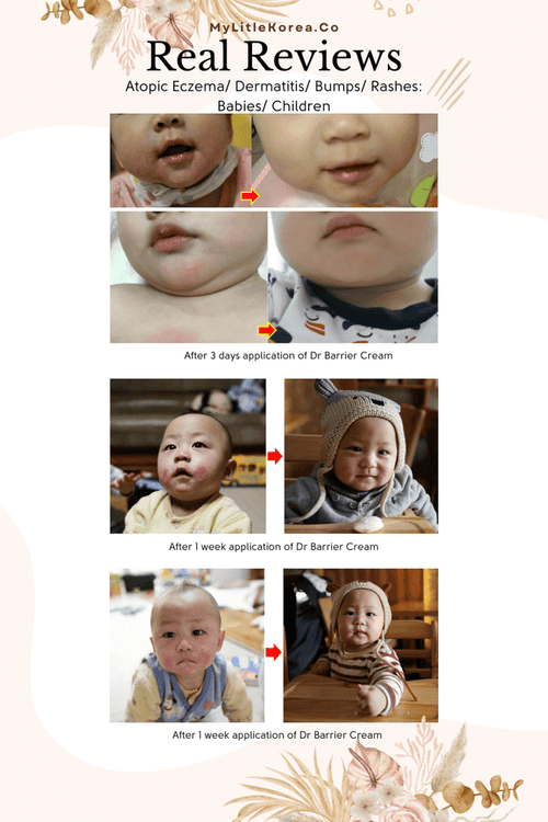 Benefie' BARRIER Renew Cream Korean Moisturizing Cosmetic For Baby Skin, Children and Sensitive Elderly Skin