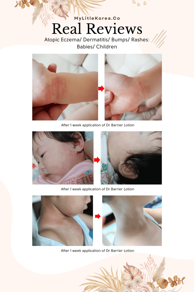 Benefie' BARRIER Renew Cream Korean Moisturizing Cosmetic For Baby Skin, Children and Sensitive Elderly Skin