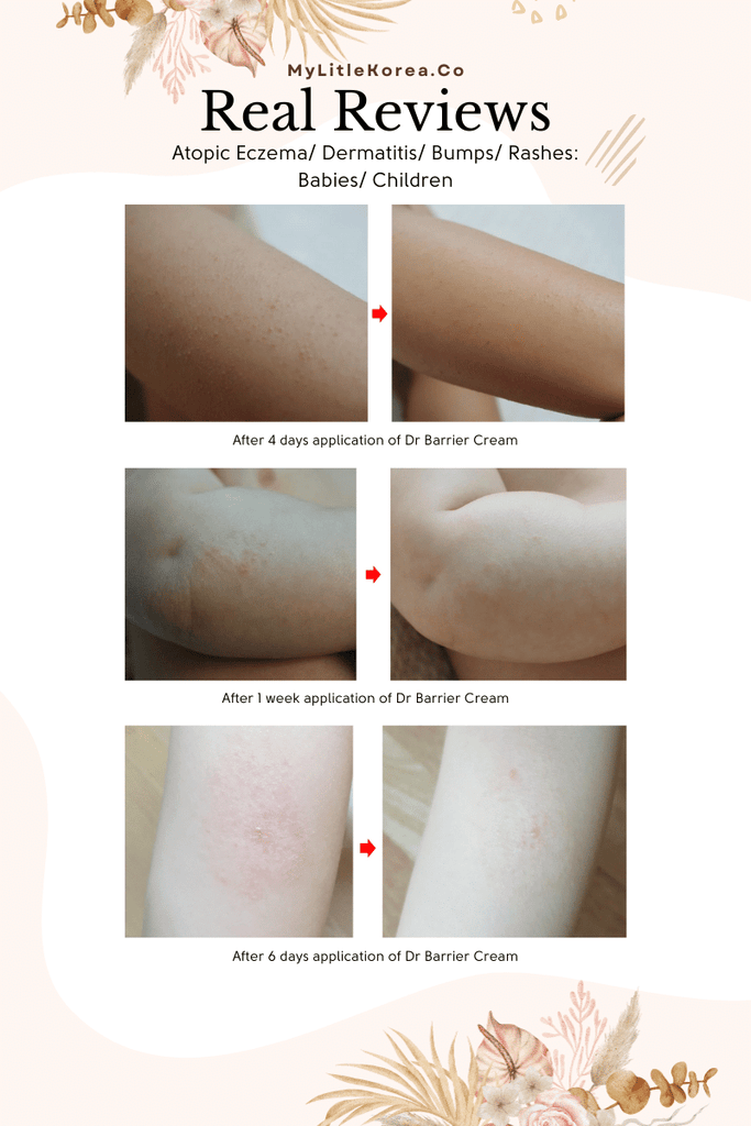 Benefie' BARRIER Renew Cream Korean Moisturizing Cosmetic For Baby Skin, Children and Sensitive Elderly Skin