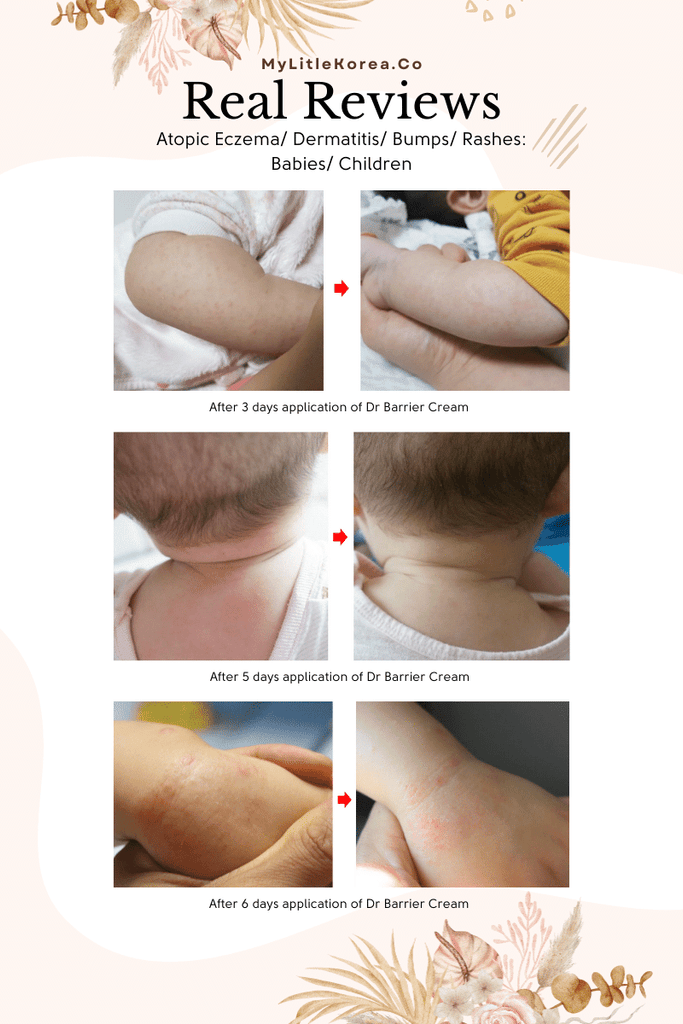 Benefie' BARRIER Renew Cream Korean Moisturizing Cosmetic For Baby Skin, Children and Sensitive Elderly Skin