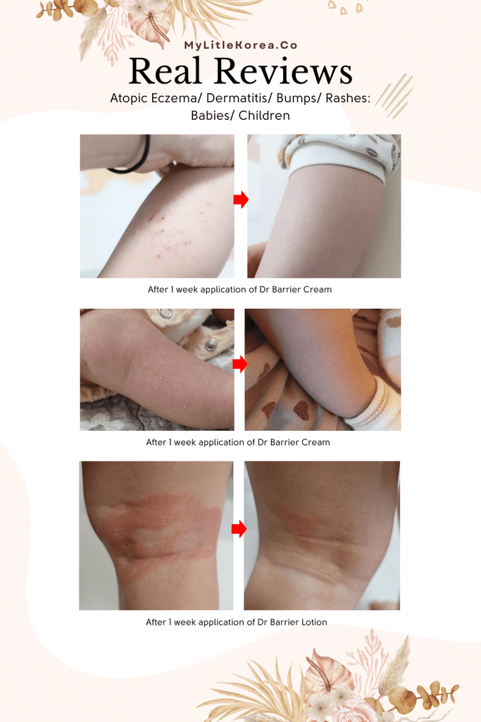 Benefie' BARRIER Renew Cream Korean Moisturizing Cosmetic For Baby Skin, Children and Sensitive Elderly Skin