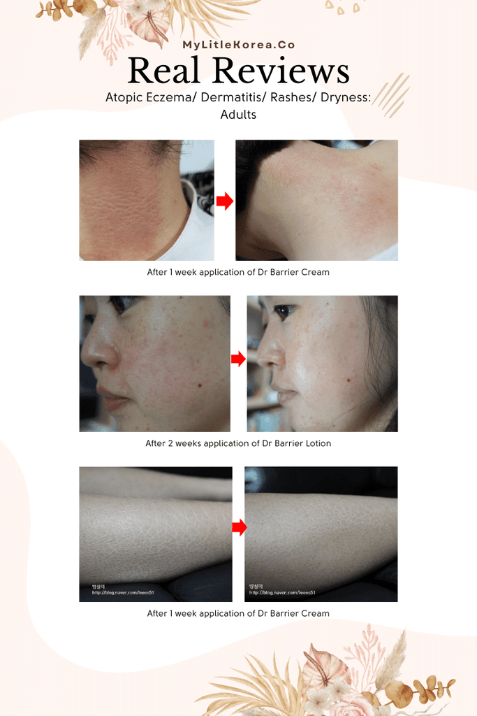 Benefie' BARRIER Renew Cream Korean Moisturizing Cosmetic For Baby Skin, Children and Sensitive Elderly Skin