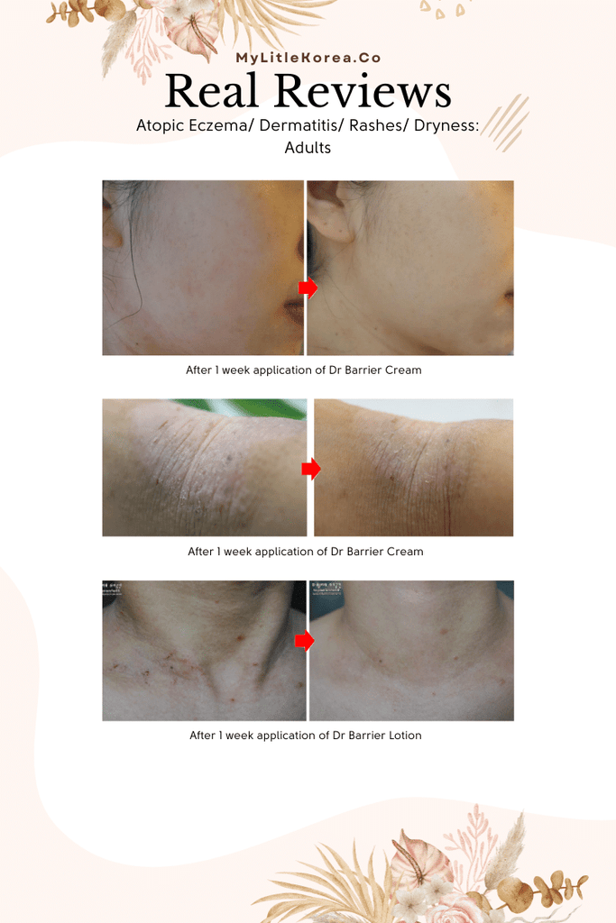 Benefie' BARRIER Renew Cream Korean Moisturizing Cosmetic For Baby Skin, Children and Sensitive Elderly Skin