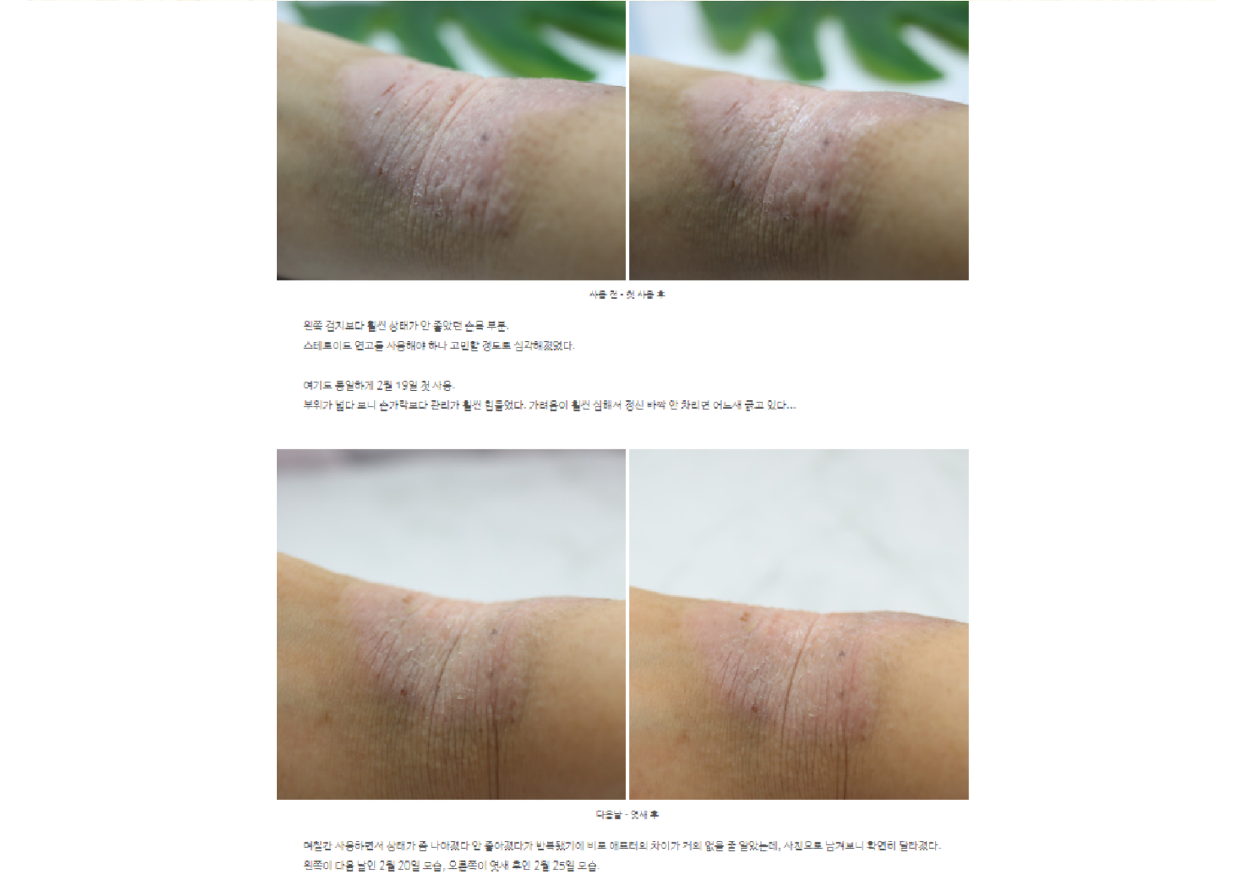 Benefie' BARRIER Renew Cream Korean Moisturizing Cosmetic For Baby Skin, Children and Sensitive Elderly Skin