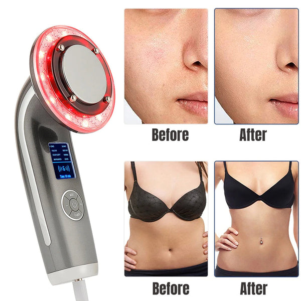 Multifunction 8 in 1 Slimming Beauty Device